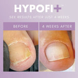 HypoFix™ Repair Serum - thePINKchair.ca - Prep - the GEL bottle