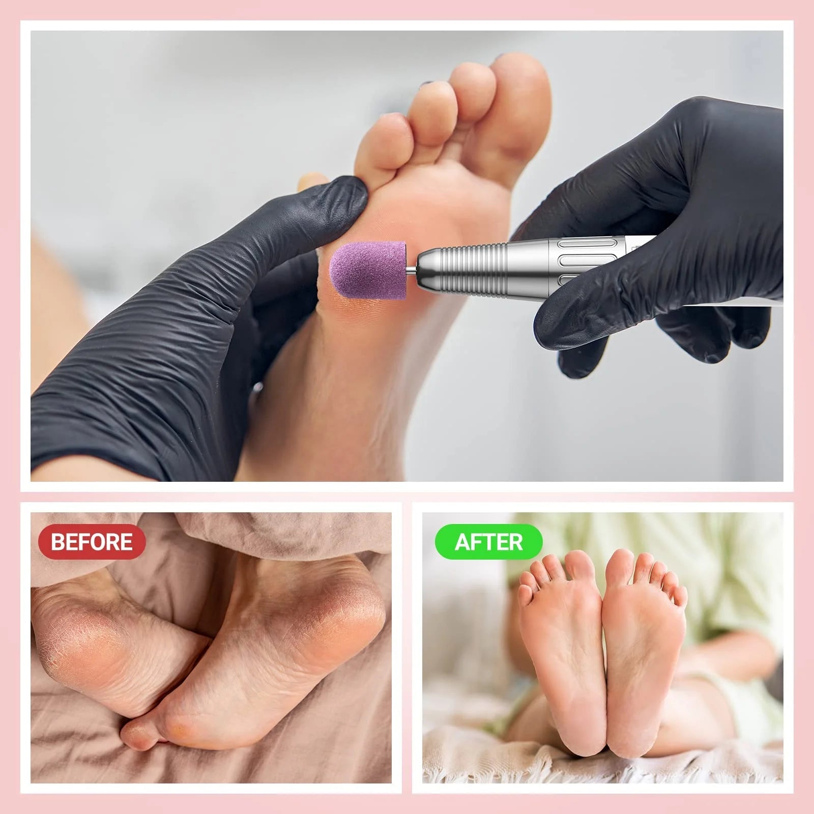 Nail Sanding Caps With A Rubber Mandrel Bit Purple - 13mm - thePINKchair.ca - Pedicure - Melody Susie